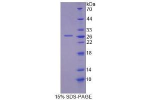 SDS-PAGE analysis of Mouse GFM2 Protein.