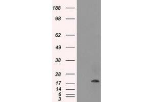 HEK293T cells were transfected with the pCMV6-ENTRY control (Left lane) or pCMV6-ENTRY CRYAB (Right lane) cDNA for 48 hrs and lysed. (CRYAB antibody)