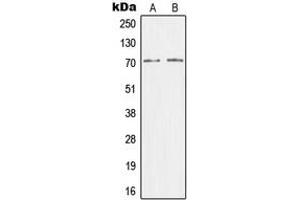 Western blot analysis of CRSP7 expression in HEK293T (A), HeLa (B) whole cell lysates. (MED26 antibody  (N-Term))