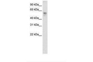 BTBD3 antibody  (C-Term)