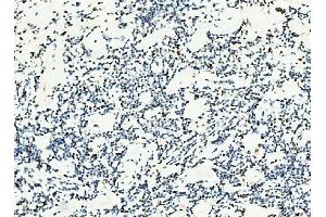 IHC analysis of MCM6 using anti-MCM6 antibody (ABIN7600037).