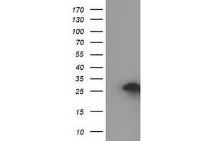HEK293T cells were transfected with the pCMV6-ENTRY control (Left lane) or pCMV6-ENTRY ZFAND2B (Right lane) cDNA for 48 hrs and lysed. (ZFAND2B antibody)