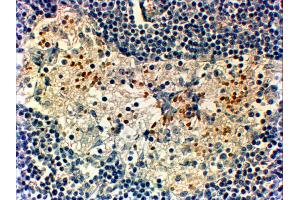 Immunohistochemistry (IHC) image for anti-Forkhead Box C2 (MFH-1, Mesenchyme Forkhead 1) (FOXC2) (C-Term) antibody (ABIN185029)