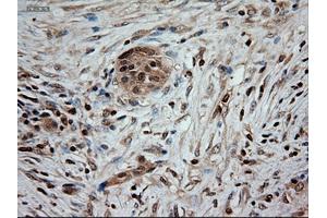 Immunohistochemical staining of paraffin-embedded kidney using anti-NTF3 (ABIN2452683) mouse monoclonal antibody.