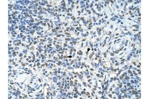ZMYND11 antibody was used for immunohistochemistry at a concentration of 4-8 ug/ml to stain Spleen cells (arrows) in Human Spleen. (ZMYND11 antibody  (Middle Region))