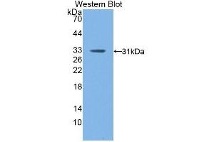 Detection of Recombinant F13A1, Mouse using Polyclonal Antibody to Coagulation Factor XIII A1 Polypeptide (F13A1) (F13A1 antibody  (AA 372-616))