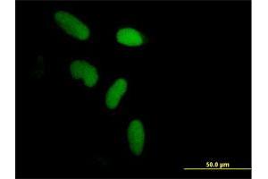 Immunofluorescence of purified MaxPab antibody to ZNF433 on HeLa cell. (ZNF433 antibody  (AA 1-638))