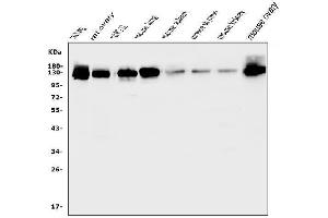 Western blot analysis of MCAM using anti-MCAM antibody (ABIN7601026). (MCAM antibody  (AA 27-621))