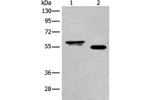 Western blot analysis of Human cervical cancer tissue and A549 cell lysates using HAS3 Polyclonal Antibody at dilution of 1:400 (HAS3 antibody)