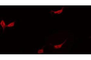 Immunofluorescence (fixed cells) (IF/ICC) image for anti-Cell Division Cycle 25 Homolog A (S. Pombe) (CDC25A) (pThr507) antibody (ABIN6255699)