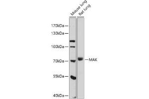 Western blot analysis of extracts of various cell lines, using MAK antibody (ABIN7268382) at 1:1000 dilution. (MAK antibody  (AA 370-435))
