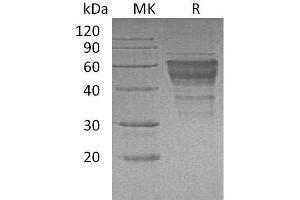 Western Blotting (WB) image for Hepatitis A Virus Cellular Receptor 2 (TIM 3) (Active) protein (Fc Tag) (ABIN7320774) (TIM3 Protein (Fc Tag))