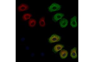 ABIN7094071 and ABIN7098115 staining Hela cells by IF/ICC. (ARHGAP10 antibody  (Internal Region))