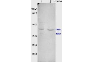 L1 rat kidney, L2 human colon carcinoma lysates probed (ABIN732098) at 1:200 in 4 °C. (Cathepsin D antibody  (AA 101-200))