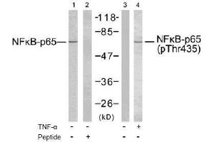 Image no. 2 for anti-Nuclear Factor-kB p65 (NFkBP65) (Thr435) antibody (ABIN197113) (NF-kB p65 antibody  (Thr435))