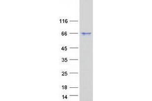 Western Blotting (WB) image for Zinc Finger CCCH-Type Containing 15 (ZC3H15) protein (Myc-DYKDDDDK Tag) (ABIN2735792)