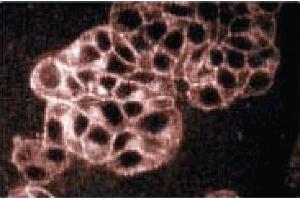 Immunofluoresence staining of PC12 cells (rat neuroblastoma, ATCC CRL 1721). (Synaptophysin antibody  (AA 205-306))