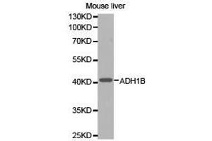 Western Blotting (WB) image for anti-Alcohol Dehydrogenase 1B (Class I), beta Polypeptide (ADH1B) antibody (ABIN1870818) (ADH1B antibody)