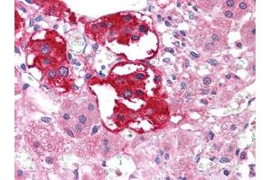 Immunohistochemical analysis of paraffin-embedded human Adrenal tissues using EPHB3 mouse mAb (EPH Receptor B3 antibody  (AA 39-212))