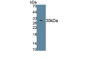 Detection of Recombinant DRD2, Canine using Polyclonal Antibody to Dopamine Receptor D2 (DRD2) (Dopamine d2 Receptor antibody)