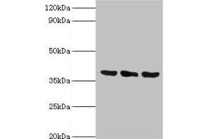 Western blot All lanes: TMOD3 antibody at 5 μg/mL Lane 1: Jurkat whole cell lysate Lane 2: MCF-7 whole cell lysate Lane 3: Hela whole cell lysate Secondary Goat polyclonal to rabbit IgG at 1/10000 dilution Predicted band size: 40 kDa Observed band size: 40 kDa