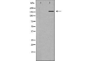 Western blot analysis of extracts of 293T , using ABCA6 antibody. (ABCA6 antibody)