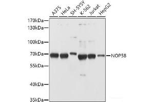 Western blot analysis of extracts of various cell lines using NOP58 Polyclonal Antibody at dilution of 1:1000. (NOP58 antibody)