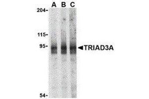 Western Blotting (WB) image for anti-Ring Finger Protein 216 (RNF216) (N-Term) antibody (ABIN2476944) (RNF216 antibody  (N-Term))