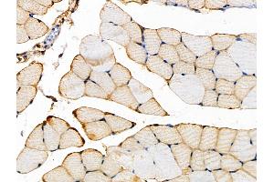 ABIN6262613 and ABIN6266565 at 1/100 staining Mouse muscle tissue by IHC-P.