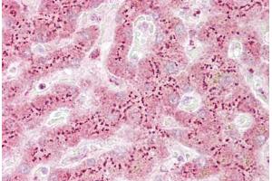 Anti-TGOLN2 / TGN46 antibody IHC staining of human liver. (TGOLN2 antibody  (AA 35-84))