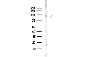 anti-Nucleolar Complex Associated 3 Homolog (NOC3L) (Internal Region) antibody
