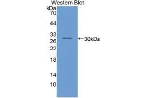 Western blot analysis of recombinant Mouse C1INH.