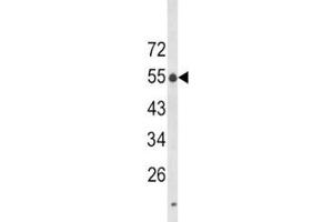 Western blot analysis of LAG3 antibody in K562 lysate. (LAG3 antibody  (AA 103-132))