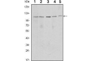Western blot analysis using SIRT1 mouse mAb against MCF-7 (1), Jurkat (2), Hela (3), HEK293 (4) and A549 (5) cell lysate.