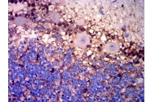 Immunohistochemical analysis of paraffin-embedded cerebellar tissues using GLUL mouse mAb with DAB staining.