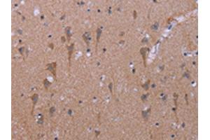 The image on the left is immunohistochemistry of paraffin-embedded Human brain tissue using ABIN7191187(KCNJ9 Antibody) at dilution 1/30, on the right is treated with synthetic peptide. (KCNJ9 antibody)