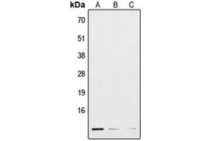 Western blot analysis of POLR3K expression in HepG2 (A), mouse lung (B), H9C2 (C) whole cell lysates. (POLR3K antibody  (Center))