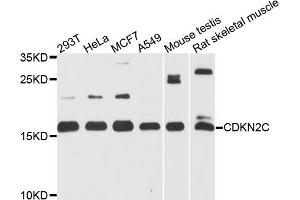 Western blot analysis of extracts of various cell lines, using CDKN2C antibody. (CDKN2C antibody)