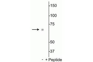 Western blot of Drosophila S2 cell lysate showing specific labeling of the ~70 kDa p70 S6K protein phosphorylated at Thr398 in the first lane (-). (RPS6KB1 antibody  (pThr398))
