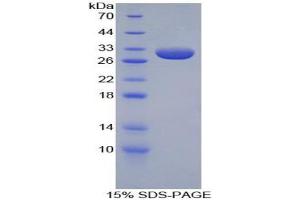 SDS-PAGE analysis of Rabbit Apolipoprotein A1 Protein. (APOA1 Protein)