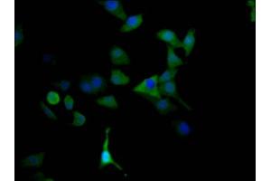 Immunofluorescence staining of HepG2 Cells with ABIN7127627 at 1:50, counter-stained with DAPI. (Recombinant Monoamine Oxidase A antibody)