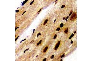 Immunohistochemical analysis of PA28 alpha staining in mouse heart formalin fixed paraffin embedded tissue section.