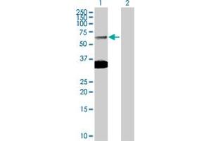 Western Blot analysis of SMAD6 expression in transfected 293T cell line by SMAD6 MaxPab polyclonal antibody. (SMAD6 antibody  (AA 1-496))