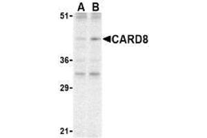 Western blot analysis of CARD8 expression in K562 cell lysate with AP30184PU-N CARD8 antibody at (A) 2 and (B) 4 μg /ml.