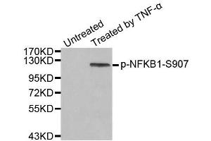 Western blot analysis of extract from HeLa cells, using phospho-NFKB1-S907 antibody (ABIN2988208). (NFKB1 antibody  (pSer907))
