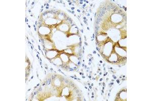 Immunohistochemistry of paraffin-embedded human colon using PRKCA antibody. (PKC alpha antibody  (C-Term))