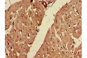 Immunohistochemistry of paraffin-embedded human heart tissue using ABIN7152606 at dilution of 1:100 (FADS1 antibody  (AA 1-121))