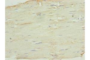 Immunohistochemistry of paraffin-embedded human skeletal muscle tissue using ABIN7169483 at dilution of 1:100 (SH3BGRL3 antibody  (AA 2-93))