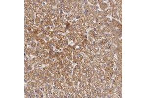 Immunohistochemical staining of human liver with OTC polyclonal antibody  shows moderate cytoplasmic positivity in hepatocytes at 1:20-1:50 dilution. (OTC antibody)