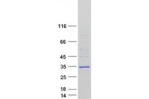 Validation with Western Blot